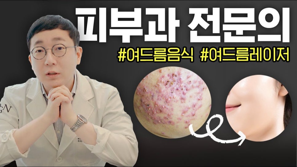 의느님 출동! 여드름 완벽 뽀개기! | 오프라이드오가나 관련 이미지 1