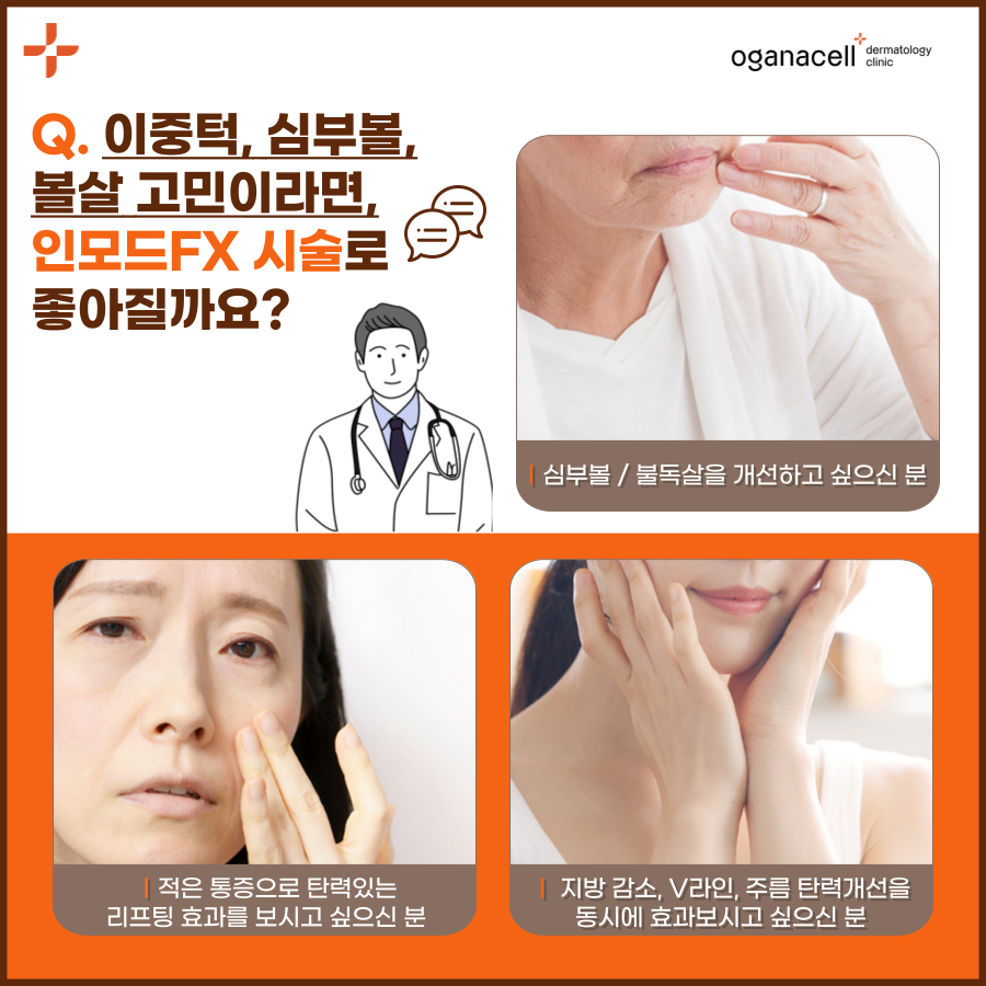 청담 인모드FX V라인완성 통증은? 관련 이미지 8