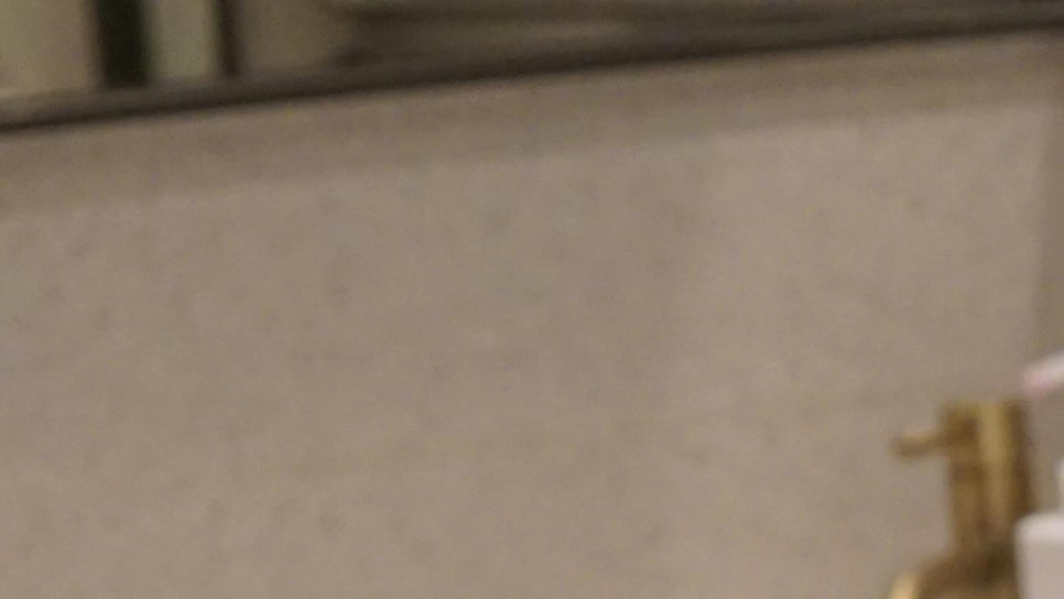 얼굴 색소침착 치료 가격만 보고 선택하면 후회합니다 관련 이미지 15