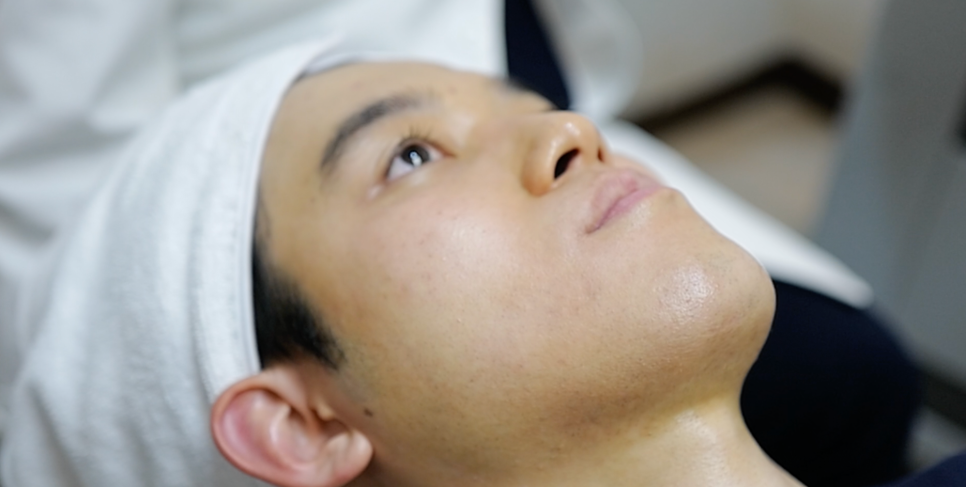 남자수염제모후기? 안 아프게 받는 방법 <대공개> 관련 이미지 6