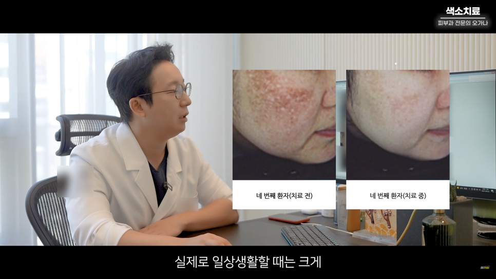 피부과 치료도 과유불급! 색소치료의 모든 것 #기미#색소병변#오타모반 | 오프라이드 오가나 관련 이미지 23