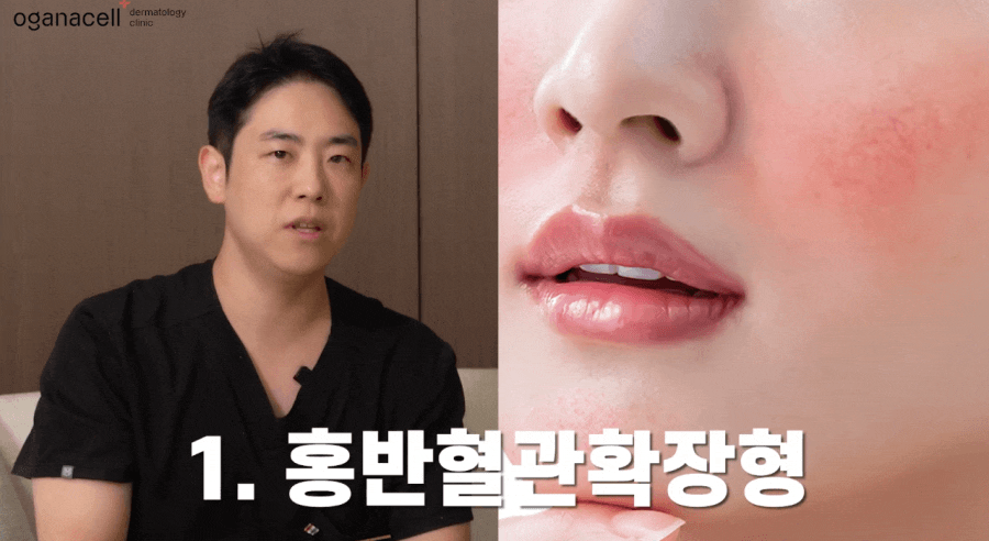 안면홍조 레이저 붉어진 얼굴 관리법 관련 이미지 4