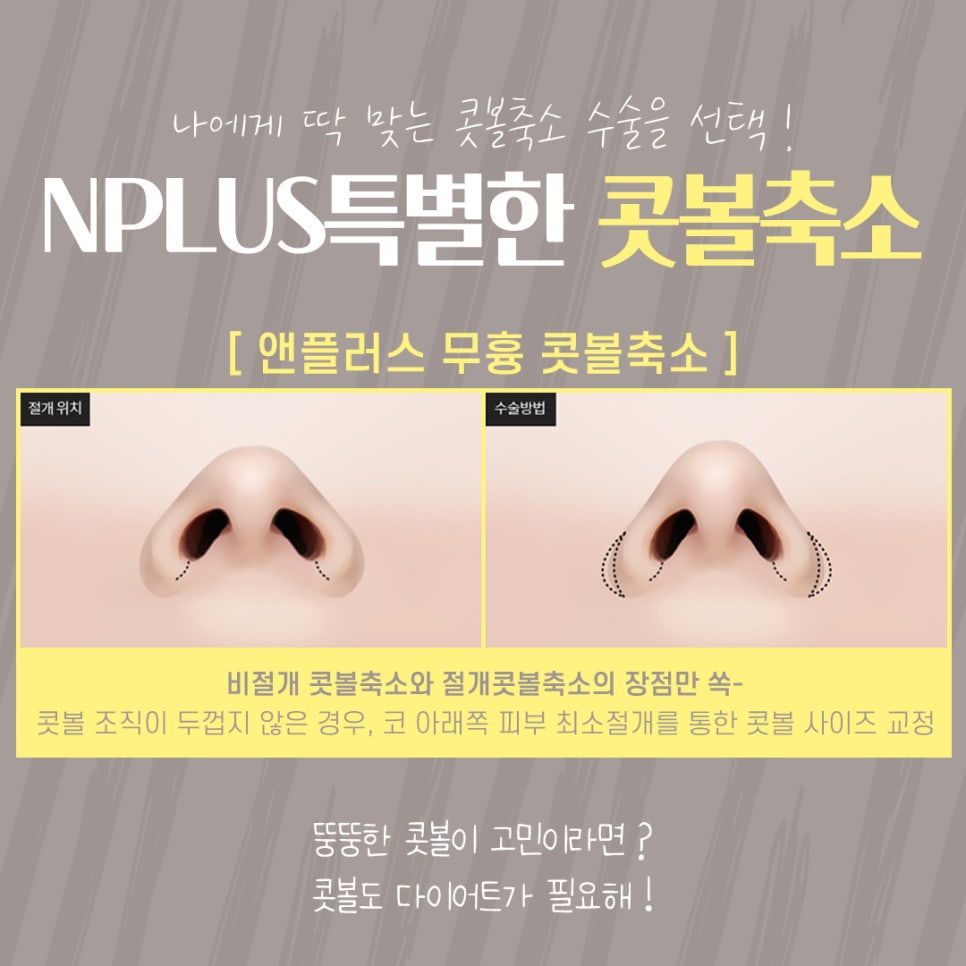 Postoperative Review of Nostril Reduction Surgery: If You’re Worried About Wide Nostrils image 8