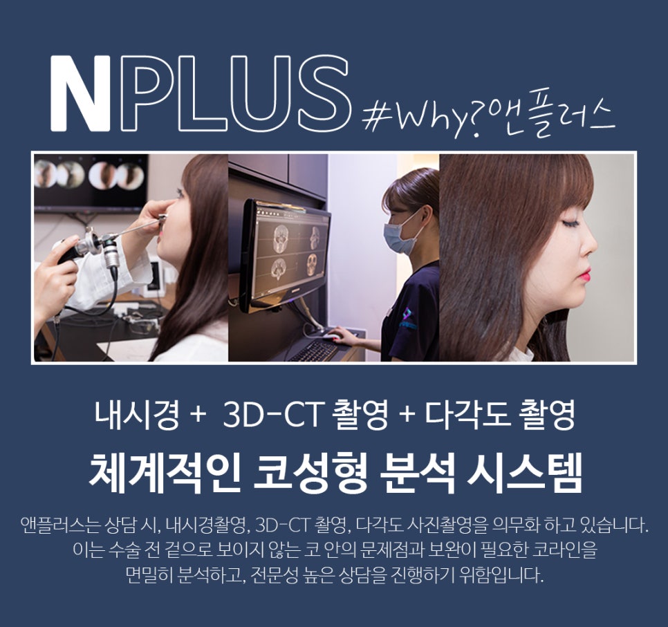 Male Rhinoplasty Review: Taking Functional Aspects into Consideration image 3