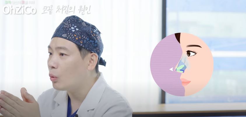 코성형 후 코끝처짐 원인과 해결 방법 관련 이미지 6