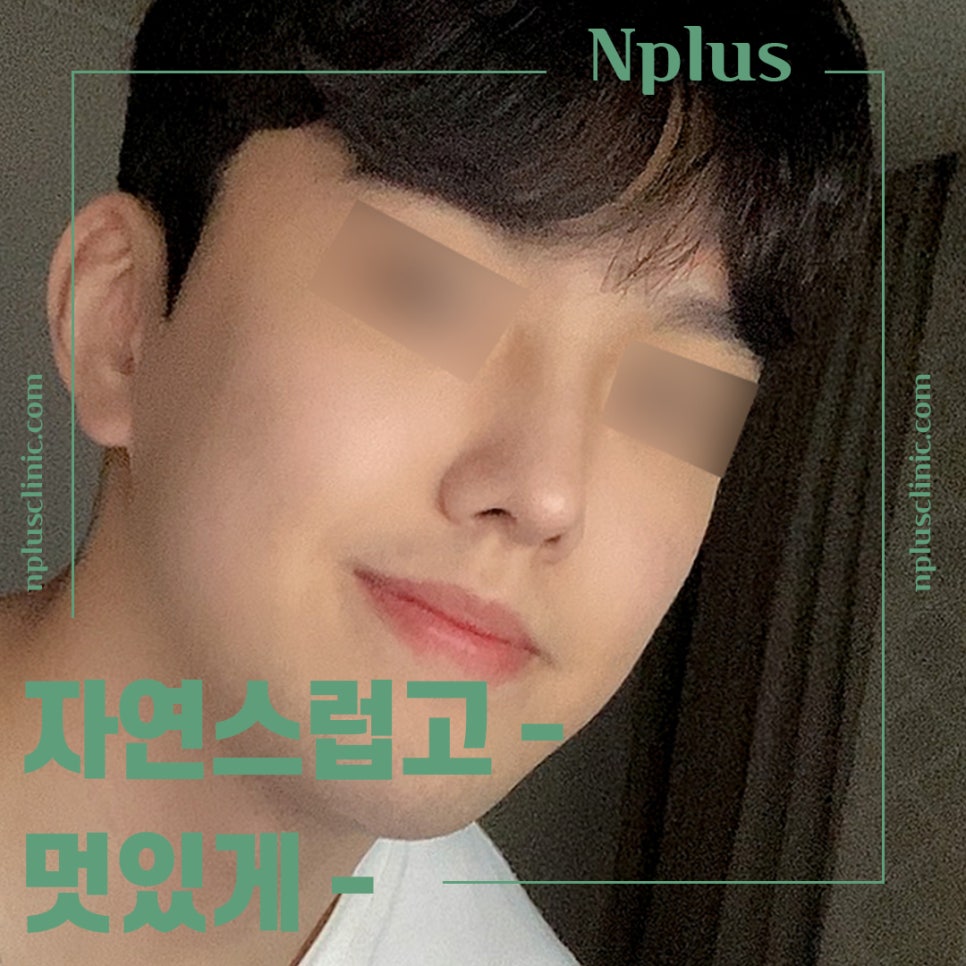 Learn More About Male Rhinoplasty Reviews in Detail image 5