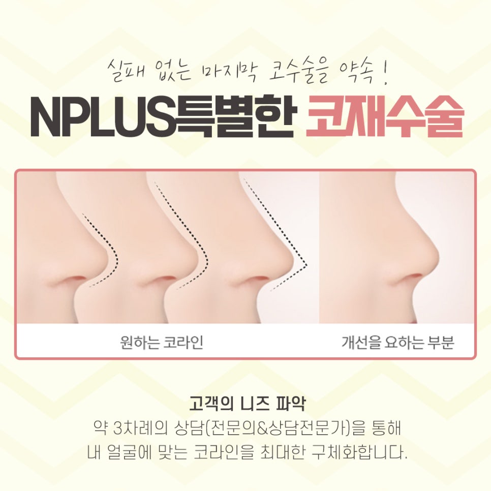 코재수술성형외과 차이를 알아보고 관련 이미지 4