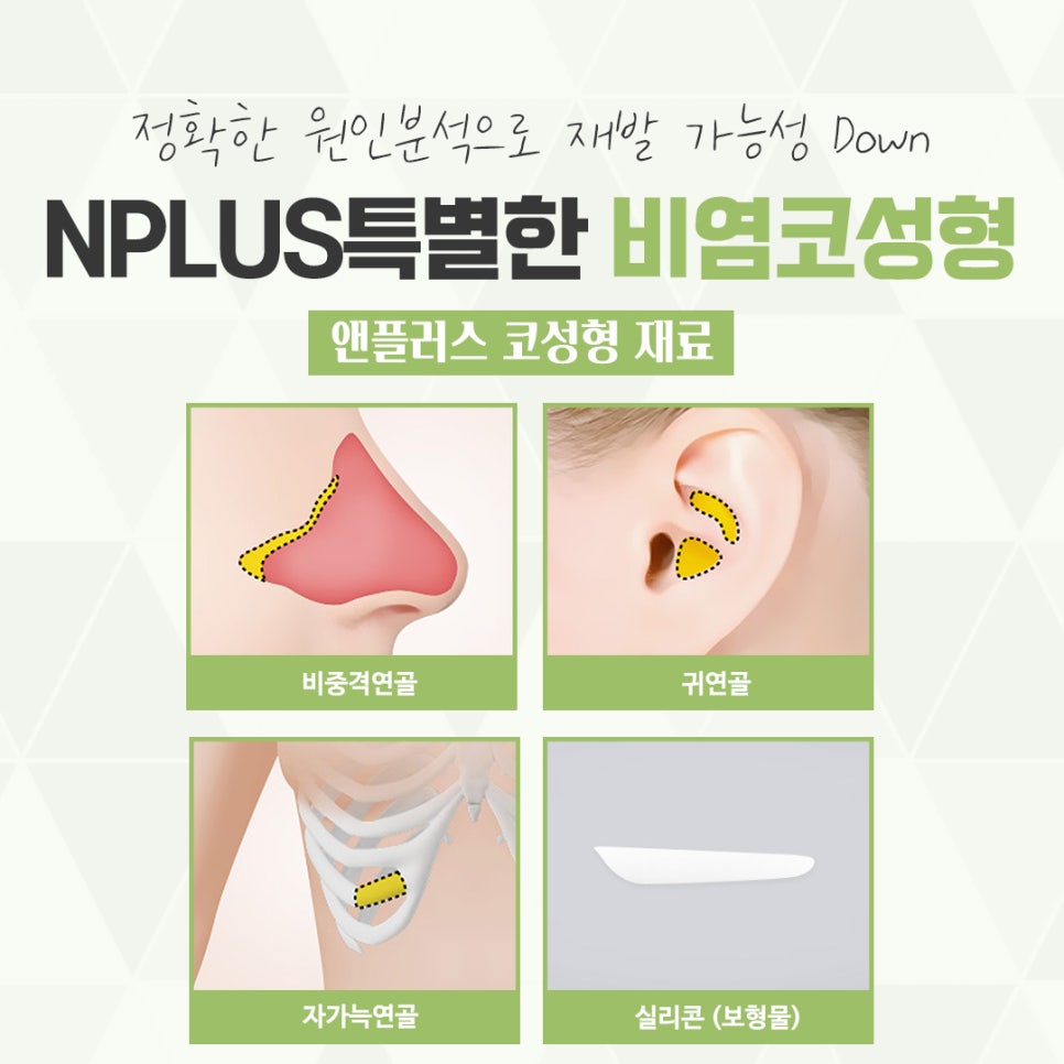 비염수술코성형 다양한 요인을 확인하여 관련 이미지 11