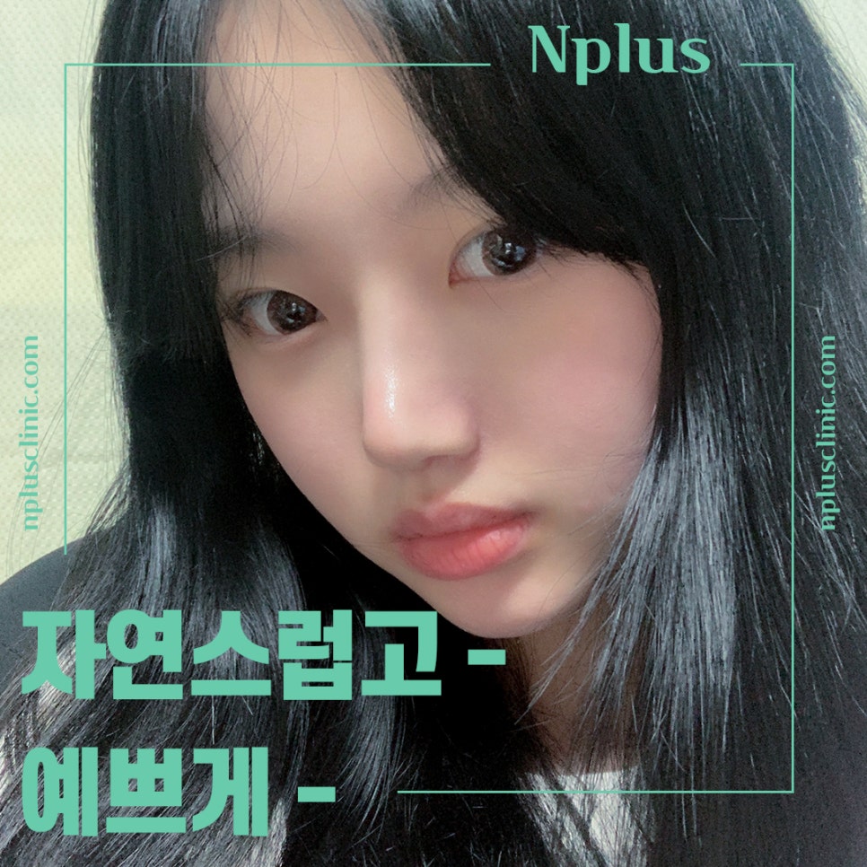 코성형후기 자연스러운 코라인으로 관련 이미지 1