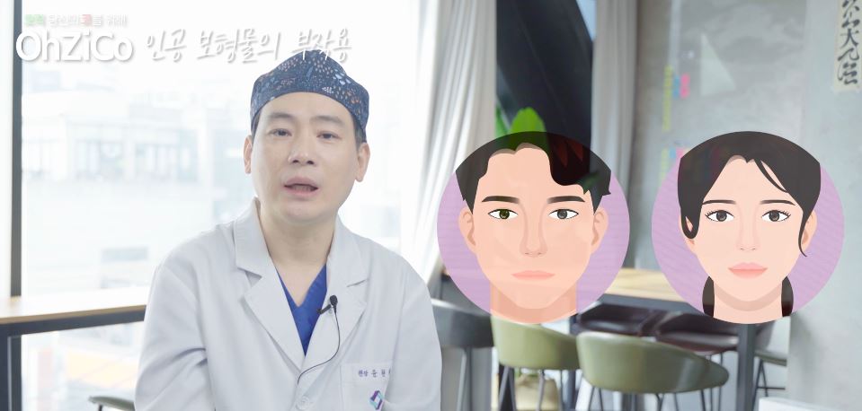 Everything About the Implants Used in Nasal Bridge Surgery image 7