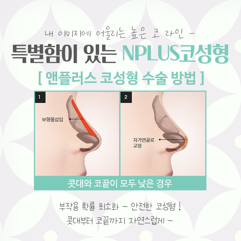 코성형잘하는곳에 대해 비교해 보고 관련 이미지 8