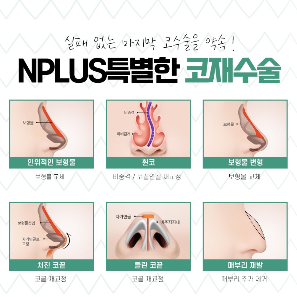 코재수술성형외과 신중하게 알아보고 관련 이미지 9