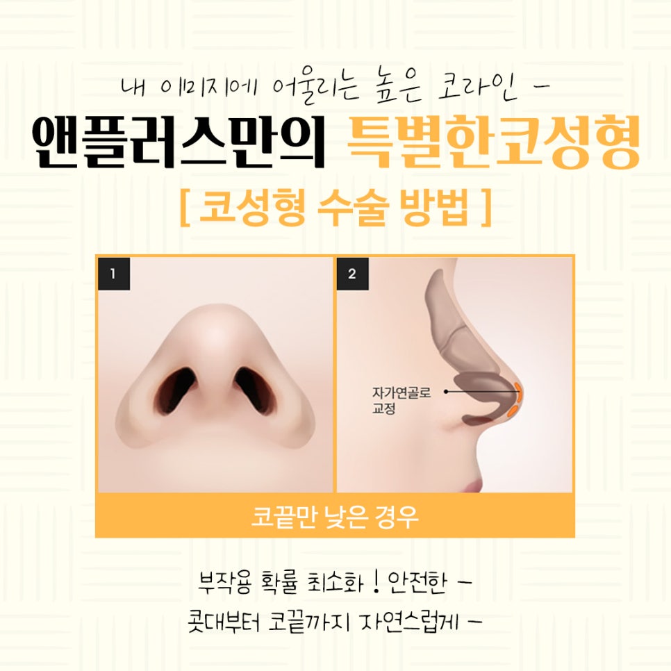Autologous Cartilage Rhinoplasty for a Natural Nose Line image 8