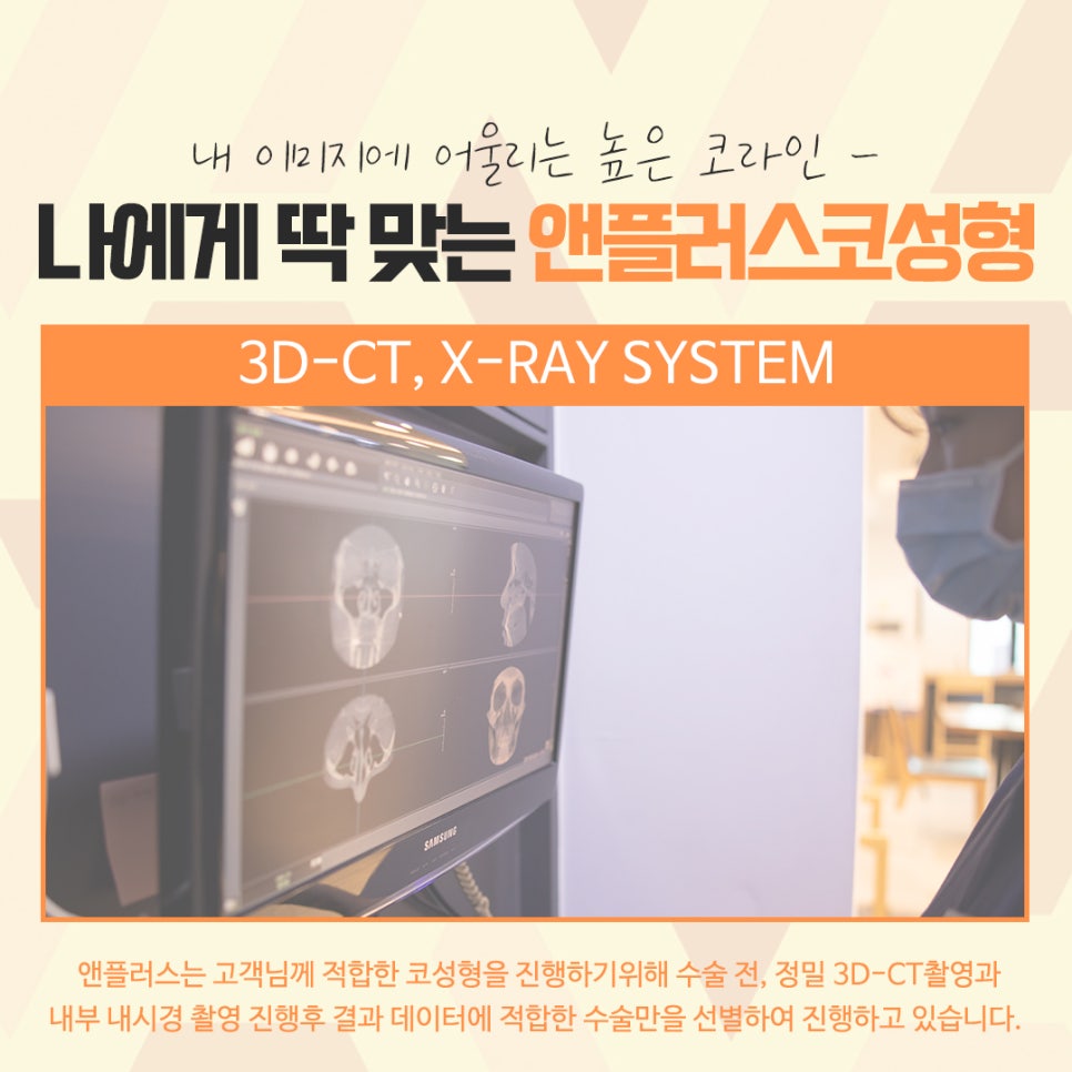 자가연골코수술을 통한 이미지 개선 관련 이미지 6