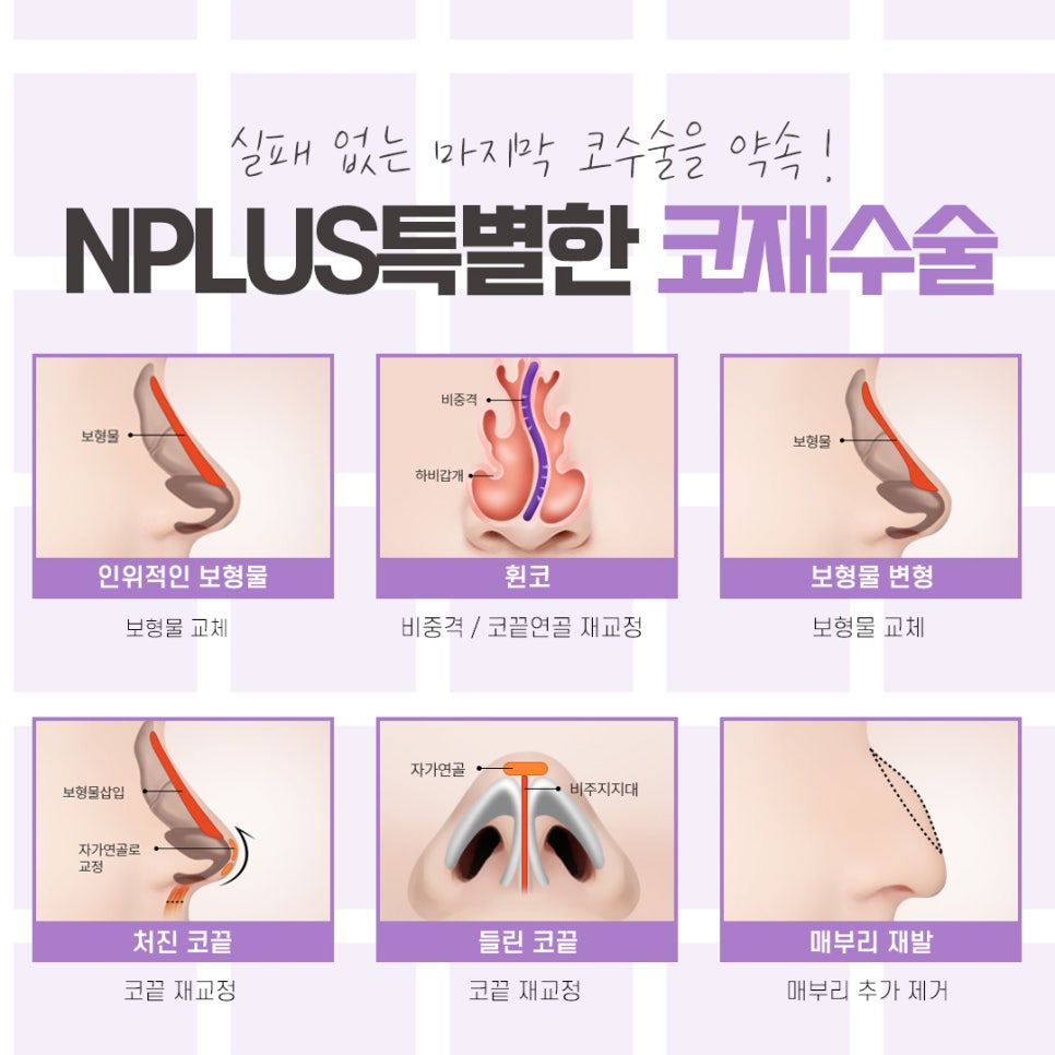 A Careful Look at the Best Place for Nose Revision Surgery image 9