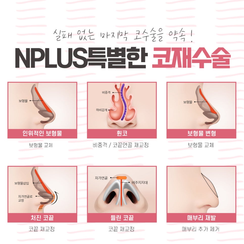 Checking the Results of a Revision Rhinoplasty Clinic image 7