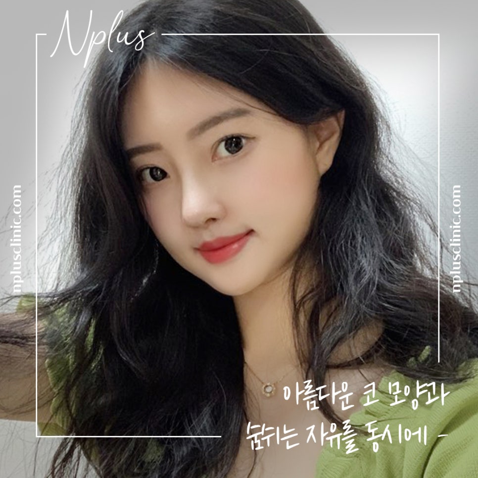 코성형 후기로 알아보고 결정 관련 이미지 1