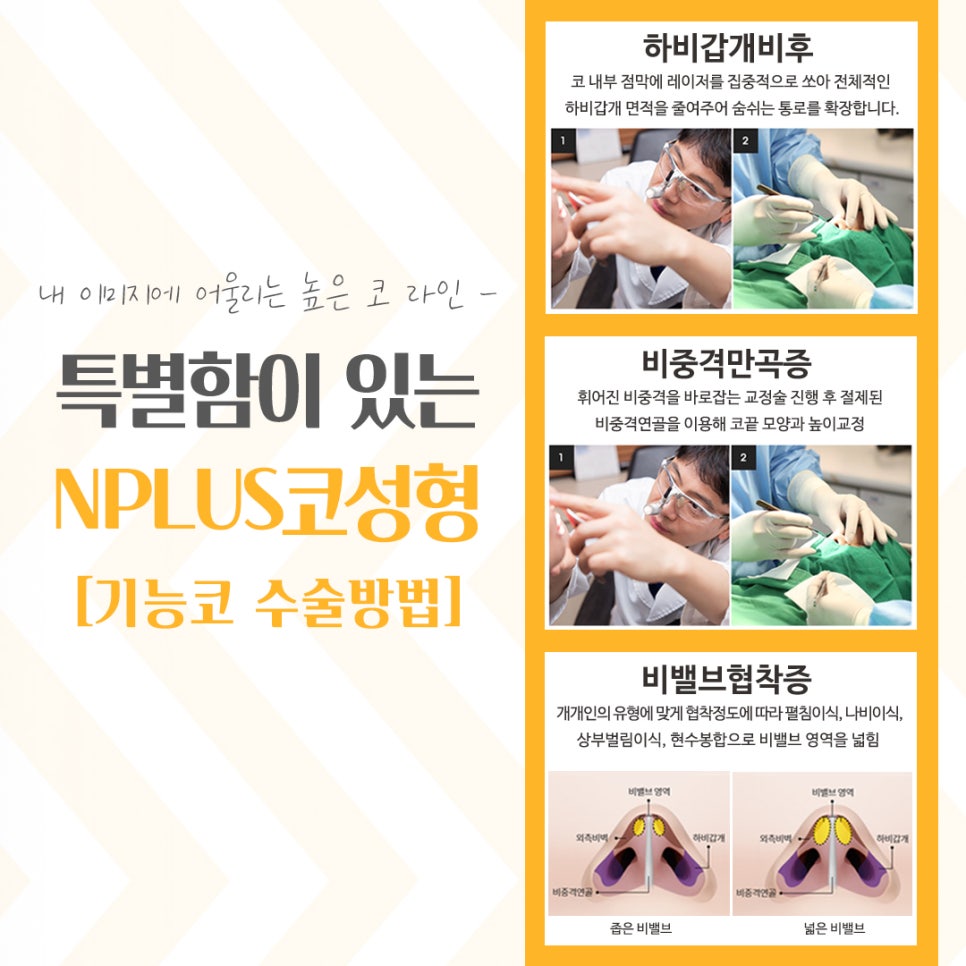 코성형잘하는곳에서 세련된 라인으로 관련 이미지 9