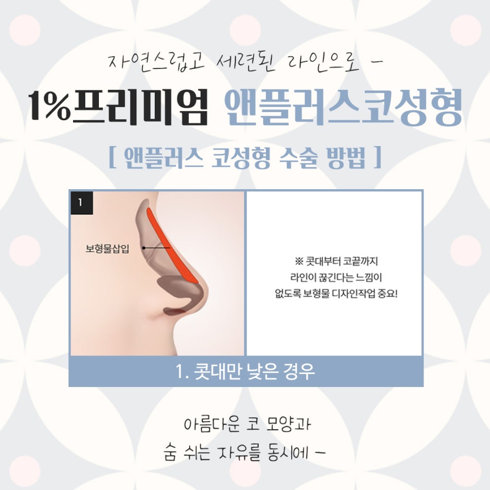 자가늑코성형에 대해 다양하게 알아보고 관련 이미지 8