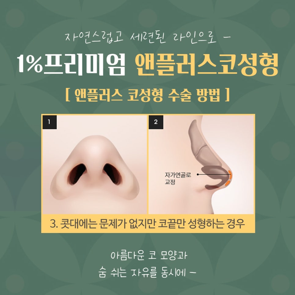 자가늑코성형 후기까지 확인하고 관련 이미지 10