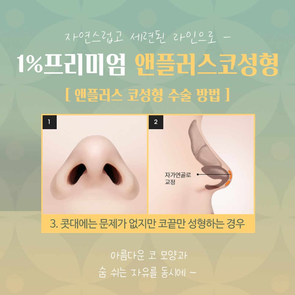 자가늑코성형 정확한 포인트를 파악하여 관련 이미지 9