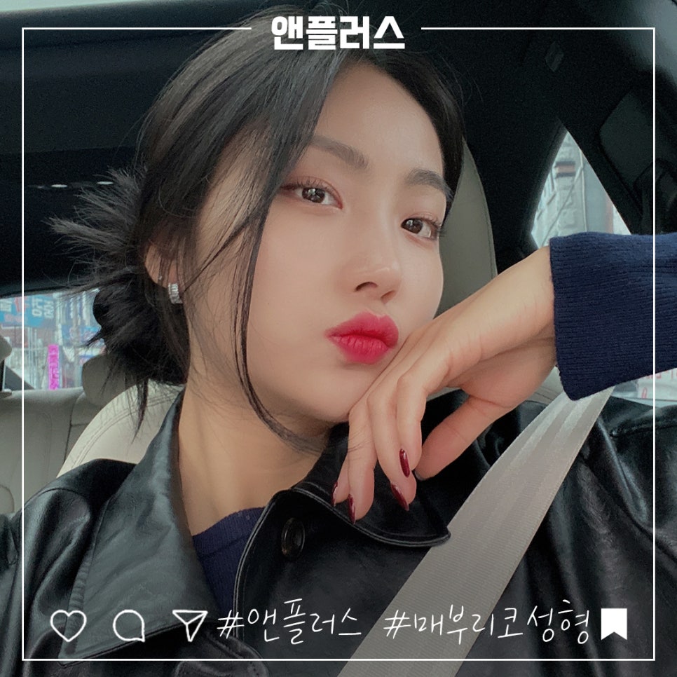 매부리코성형후기 코끝처짐을 개선하여 관련 이미지 2