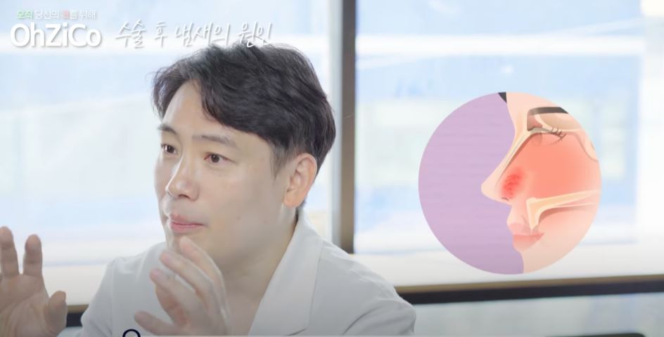 코수술 후 코냄새 원인과 해결 방법! 관련 이미지 7