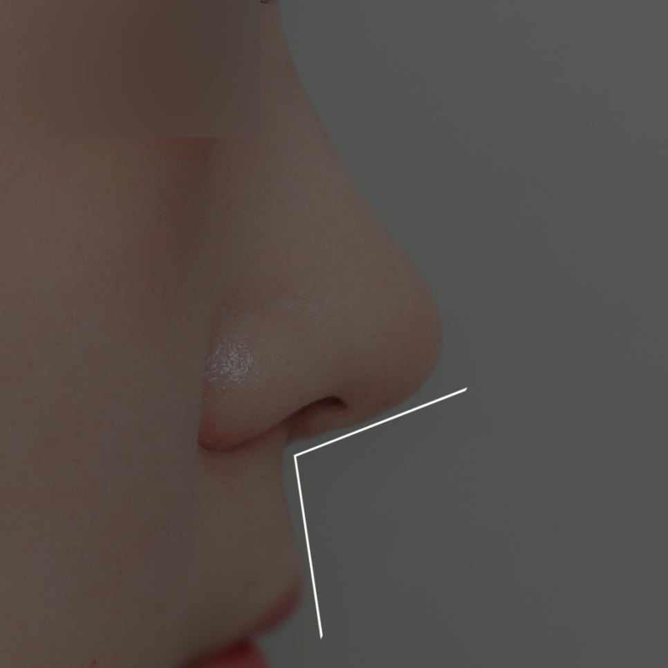 What Is the Prettiest Nose That Suits My Face Best? image 6