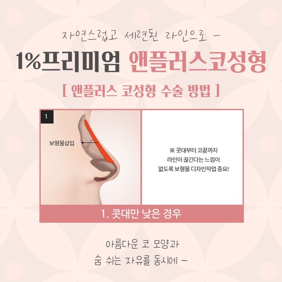 자가늑연골코성형을 통한 이미지 개선 관련 이미지 8