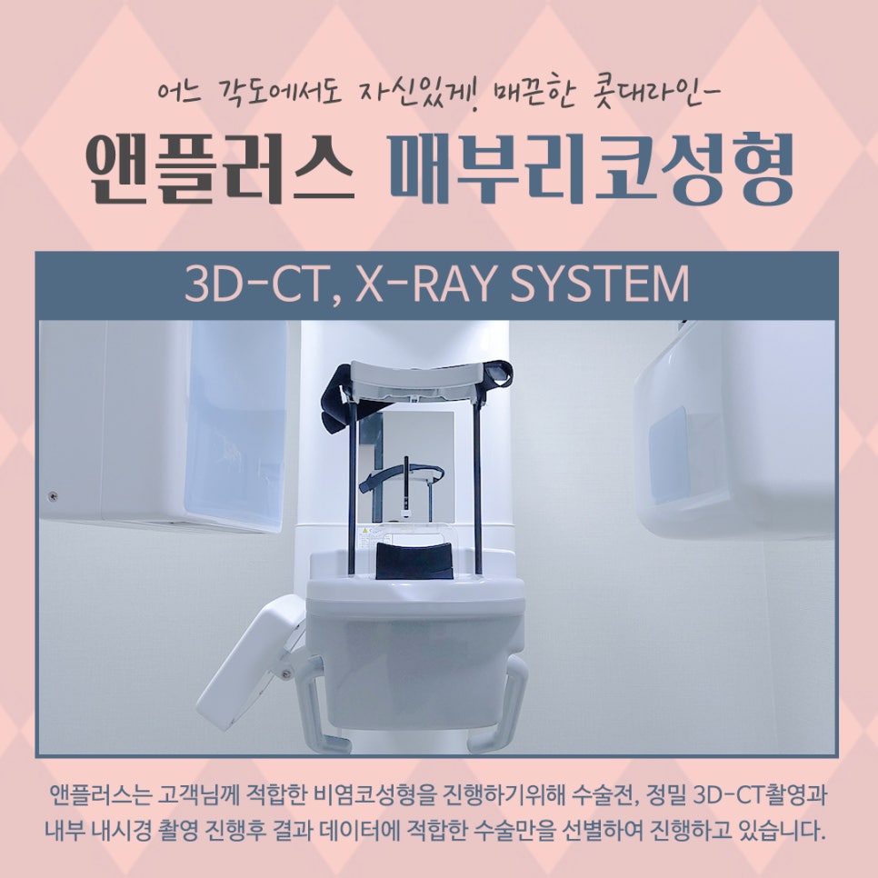 A Smooth Nasal Bridge Line Through Hump Nose Correction image 7