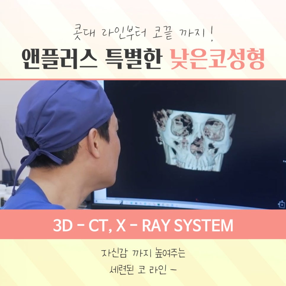 Creating a More Three-Dimensional Look with Low Nose Surgery image 6