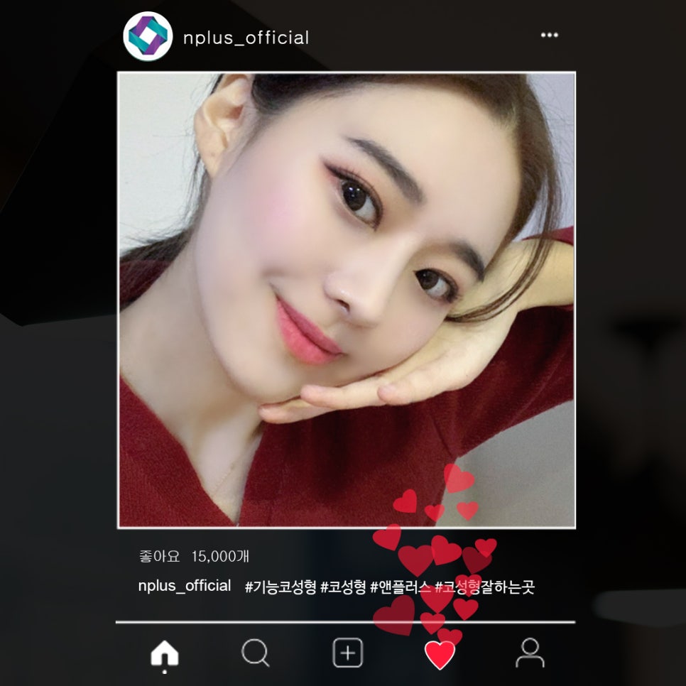 기능코성형후기 꼼꼼하게 알아보고 관련 이미지 3