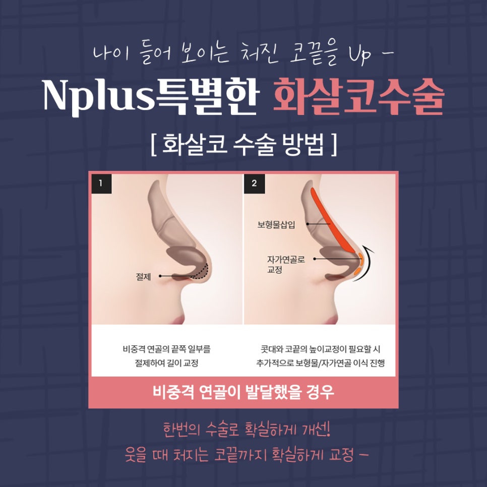 Transforming Your Look to a More Youthful Appearance After Arrow Nose Surgery image 5