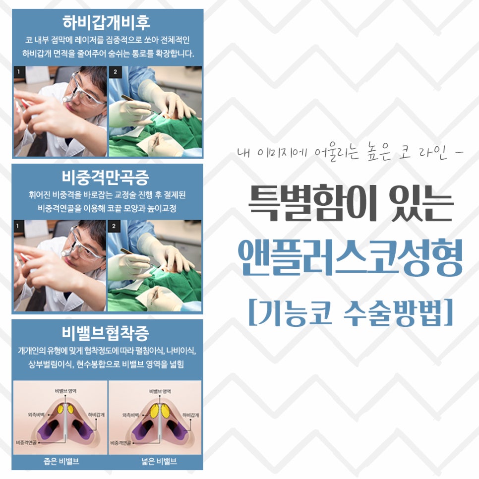 Nose Surgery Review: A Thorough Look Inside image 13