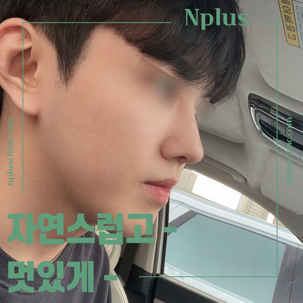 Learn More About Male Rhinoplasty Reviews in Detail image 1