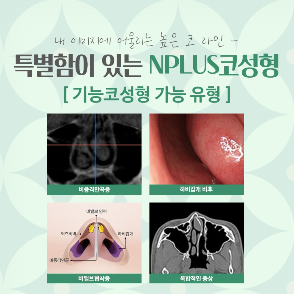 Looking into a Nose Surgery Clinic in Detail image 4