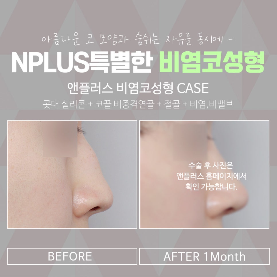 앤플러스에서 알려드리는 잠잘때코막힘 해결 관련 이미지 15