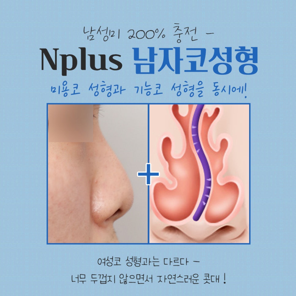 남자코성형 직선라인으로 남자답게 관련 이미지 11