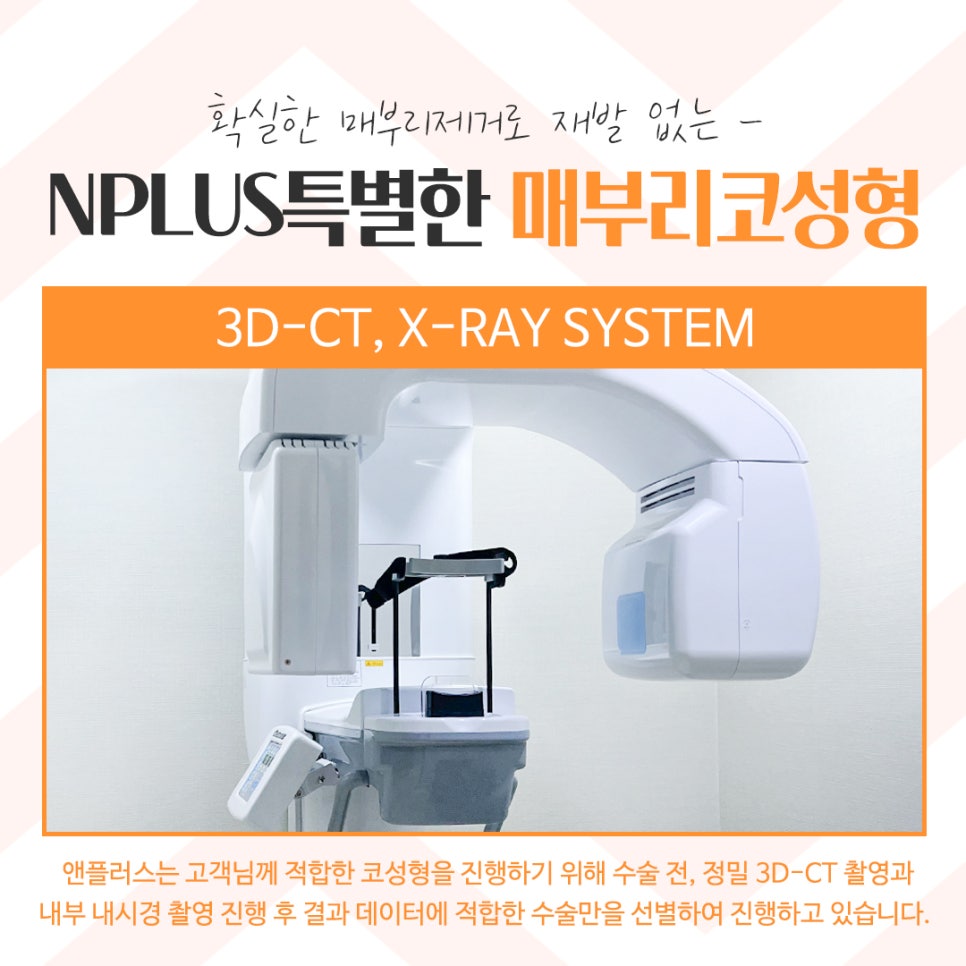 Hump Nose Surgery Review with a Clear Diagnosis image 8