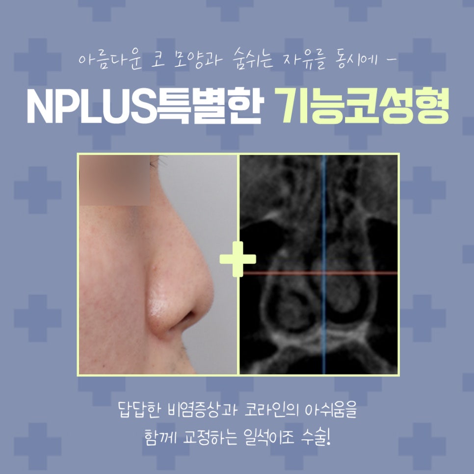 코수술보험 확실하게 알아보고 진행해야 관련 이미지 4