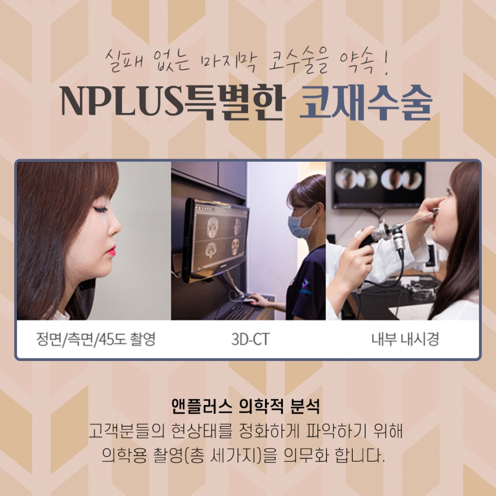 자가늑연골 활용한 코재수술후기 관련 이미지 5
