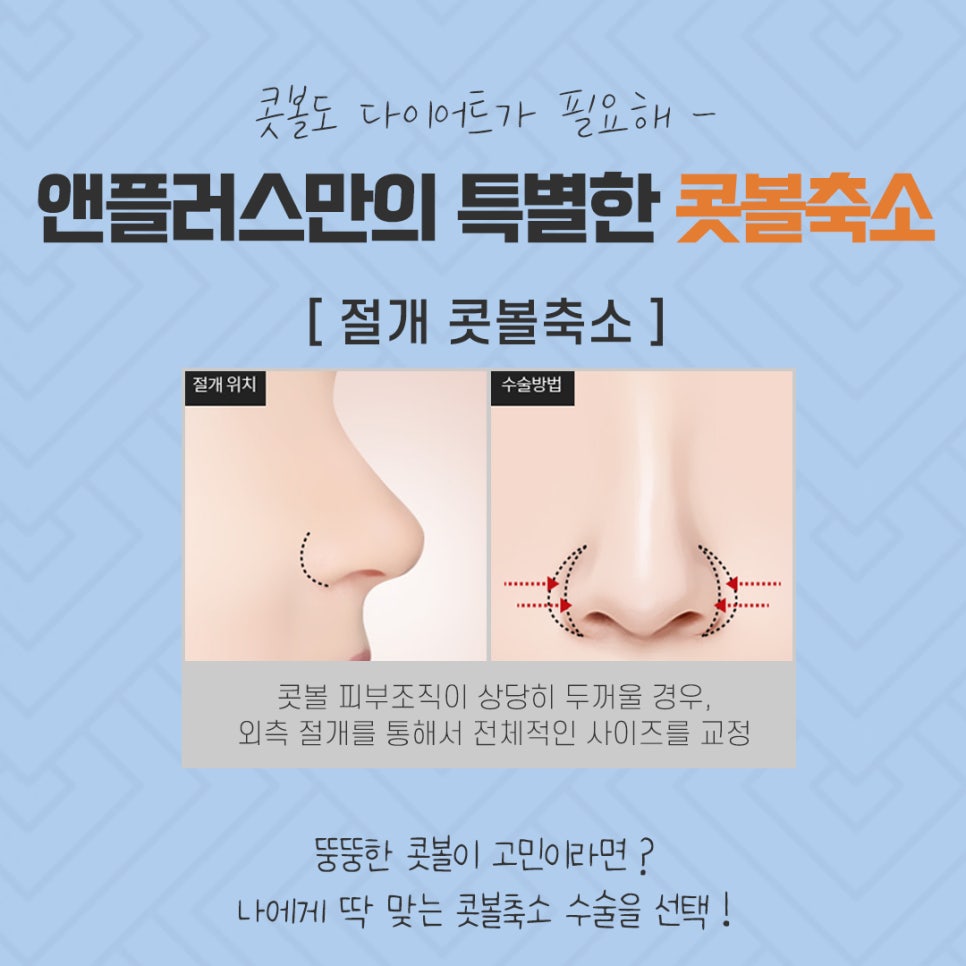 콧볼축소후기 섬세하게 알아보고 관련 이미지 10