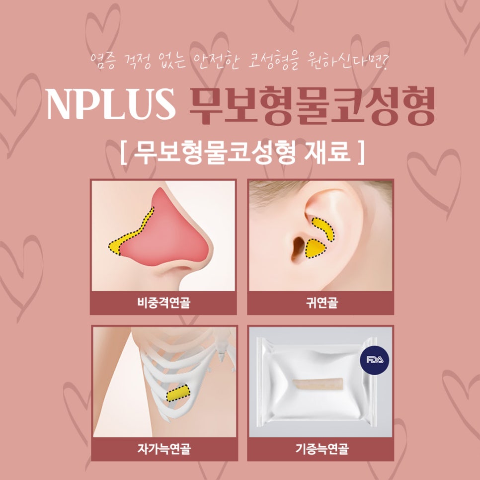 무보형물코수술후기 자연스러운 코라인으로 관련 이미지 6