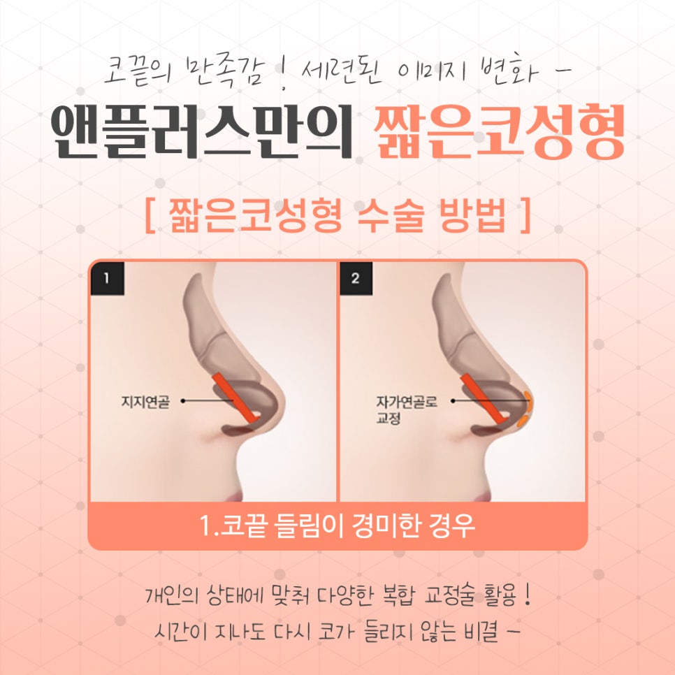 Naturally and Beautifully Through Short Nose Surgery image 9