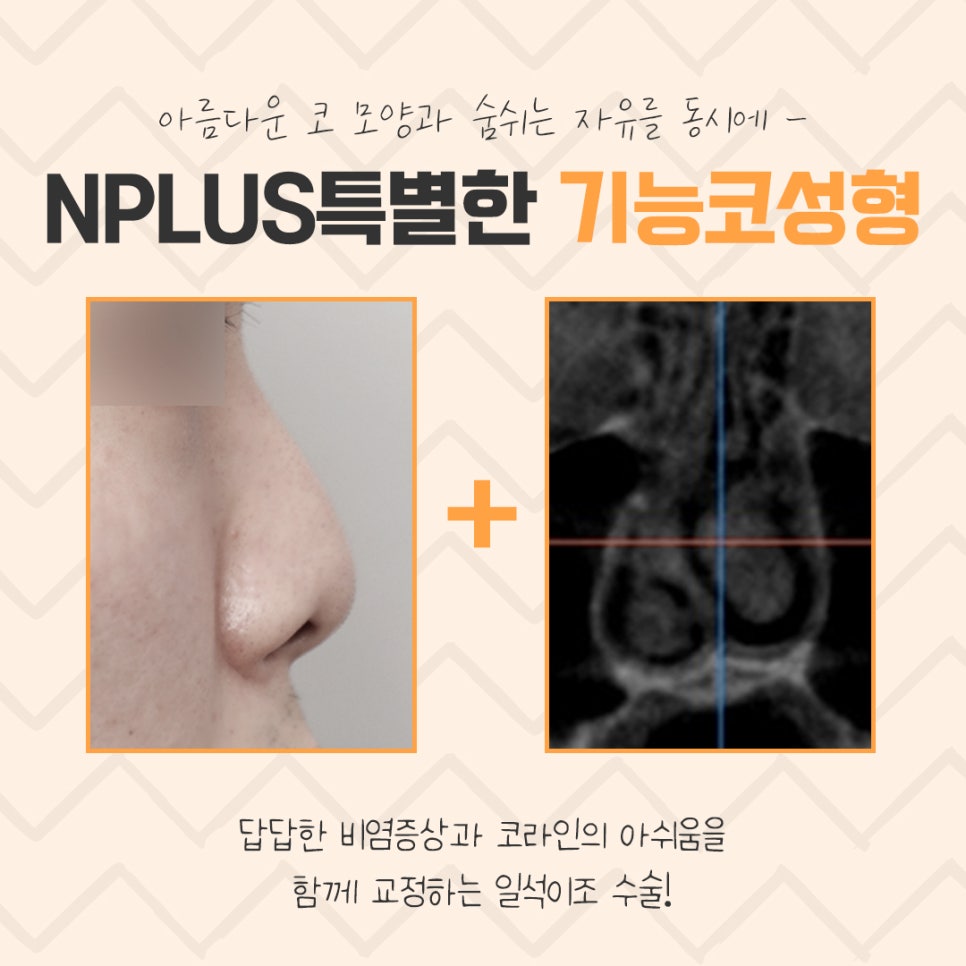 Making a Careful Decision After Researching an ENT Clinic for Rhinoplasty image 5