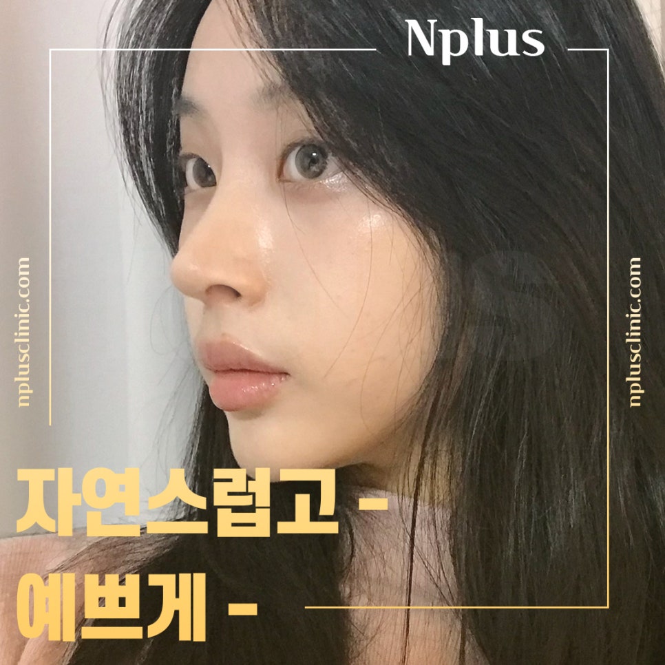 Addressing the Problems of Short Nose Surgery image 2
