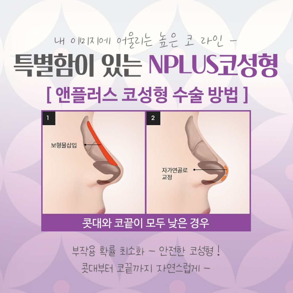 강남코수술에서 자연스럽고 예쁜 코라인! 관련 이미지 8