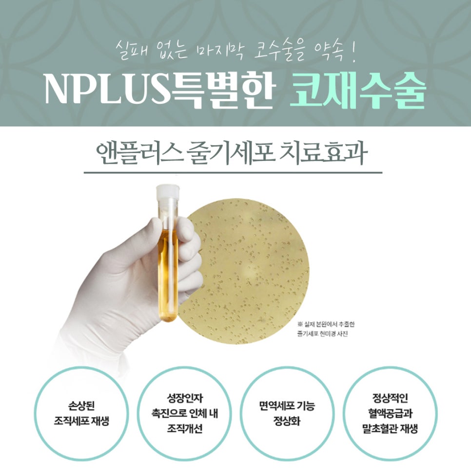 압구정성형외과에서 알아보는 코재수술후기 관련 이미지 13