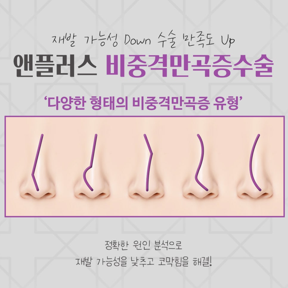 비중격만곡증수술 원인을 자세하게 관련 이미지 6