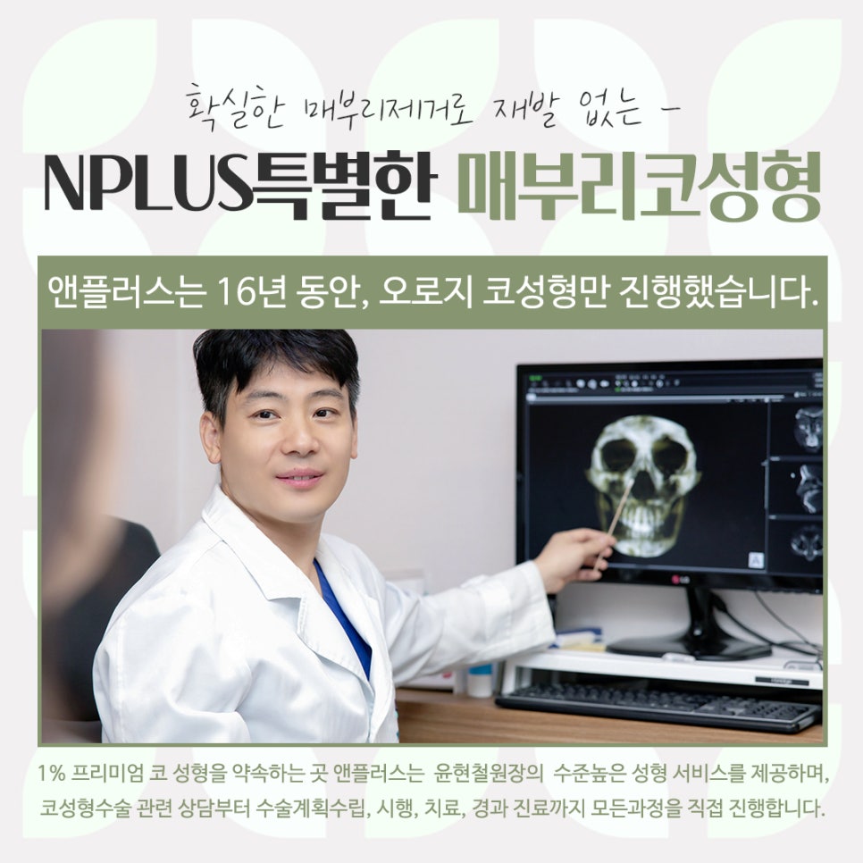 Detailed Hump Nose Surgery Review image 7